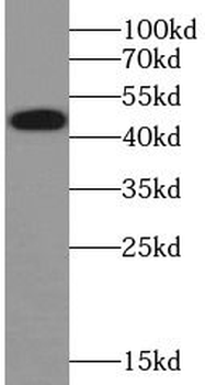 TRAIP Antibody