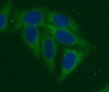 TRAIP Antibody