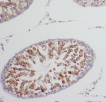 TRAIP Antibody