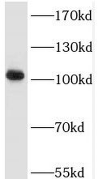 TRAK2 Antibody