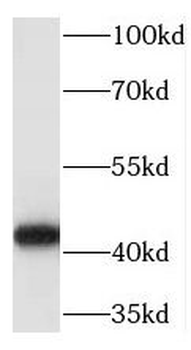 TRAM2 Rabbit Polyclonal Antibody