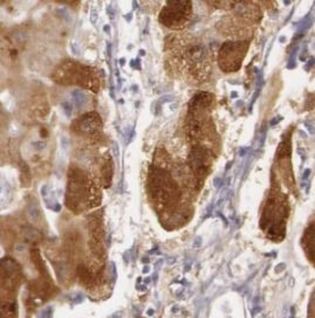 TF Rabbit Polyclonal Antibody