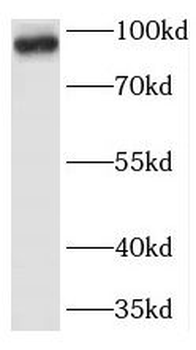 TFRC Rabbit Polyclonal Antibody