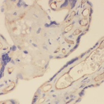 TFRC Rabbit Polyclonal Antibody