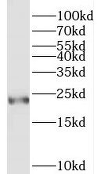 TAGLN Rabbit Polyclonal Antibody