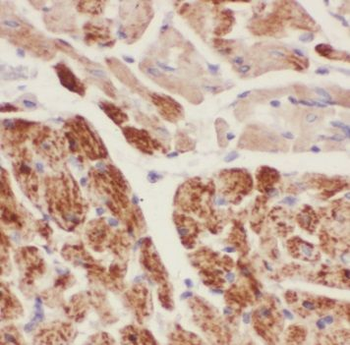 TAGLN Rabbit Polyclonal Antibody