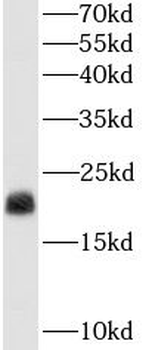 TAGLN Mouse Monoclonal Antibody
