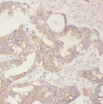 TAGLN Mouse Monoclonal Antibody