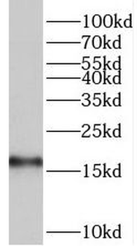 TRAPPC2 Rabbit Polyclonal Antibody
