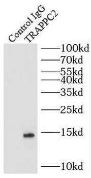 TRAPPC2 Rabbit Polyclonal Antibody