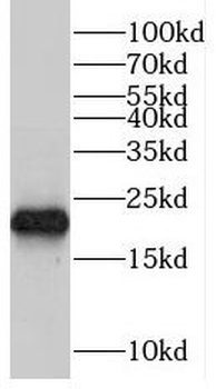 TRAPPC4 Rabbit Polyclonal Antibody