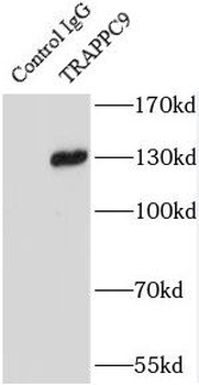 TRAPPC9 Antibody