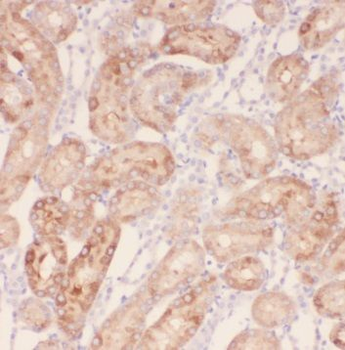 TRAPPC9 Antibody