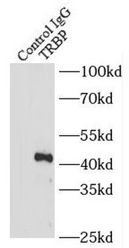 TARBP2 Antibody
