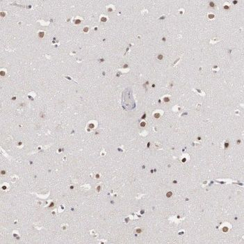 TARBP2 Antibody