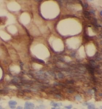 TFF3 Antibody