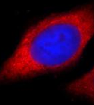 TREM1 Antibody