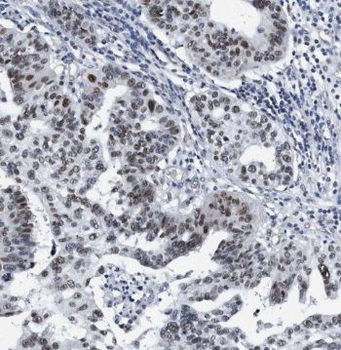 TRIM11 Antibody