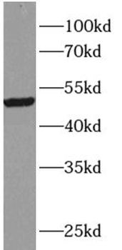 TRIM15 Antibody
