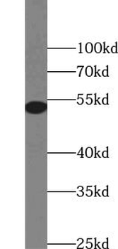 TRIM17 Antibody