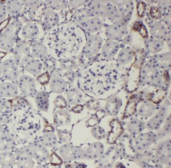 TRIM2 Antibody
