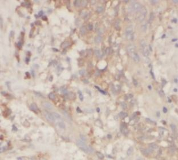 TRIM21 Antibody