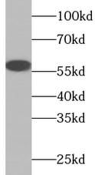 TRIM27 Antibody
