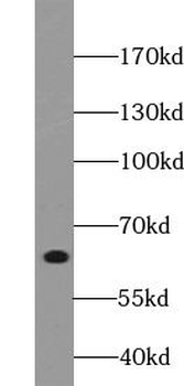 TRIM29 Antibody