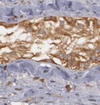 TRIM29 Antibody