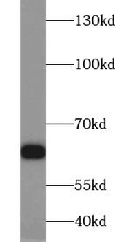 TRIM32 Rabbit Polyclonal Antibody