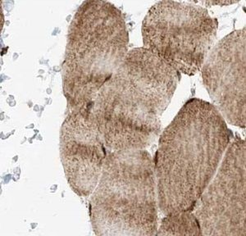 TRIM41 Antibody