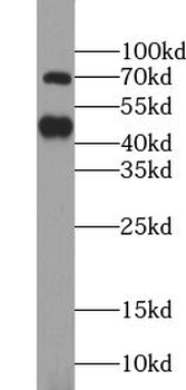 TRIM5 Antibody