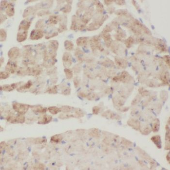 TRIM54 Antibody