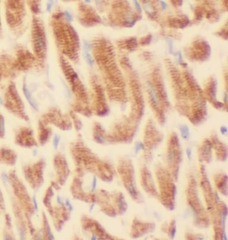 TRIM63 Antibody