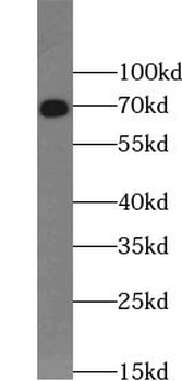 TRIM67 Rabbit Polyclonal Antibody