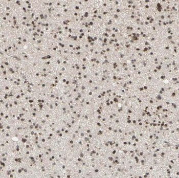 TRIM69 Antibody