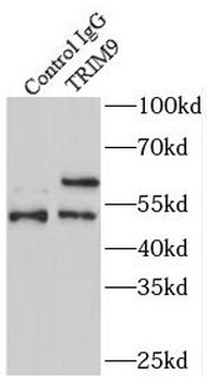 TRIM9 Antibody