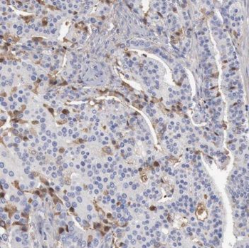 TRIM9 Antibody