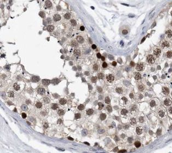 TRIP13 Antibody