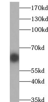 TRIP4 Rabbit Polyclonal Antibody