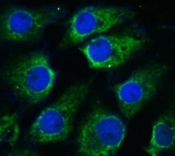 NTRK2 Antibody