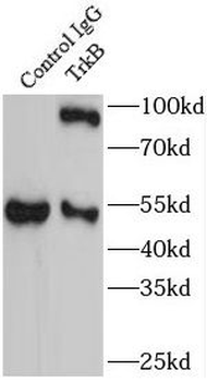 NTRK2 Antibody