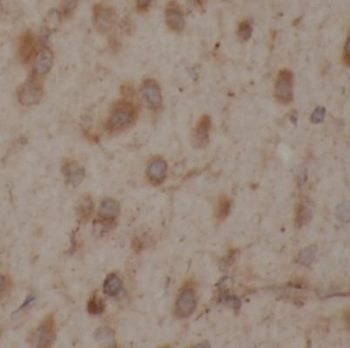 NTRK2 Antibody