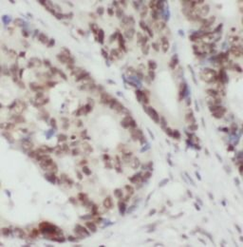 TRMT1 Antibody
