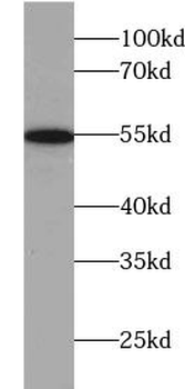 TRMT2B Antibody