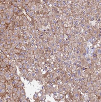 TRMT2B Antibody