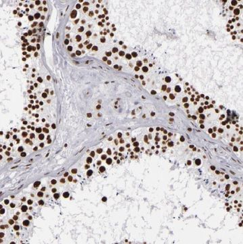 TRMT6 Antibody