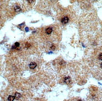 TRNAU1AP Antibody