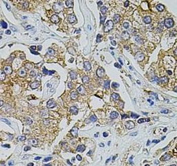 TRPA1 Antibody