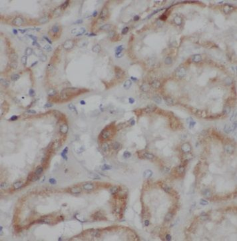 TRPC4 Antibody